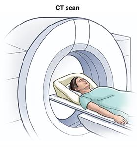 Person laying in CT scanner.